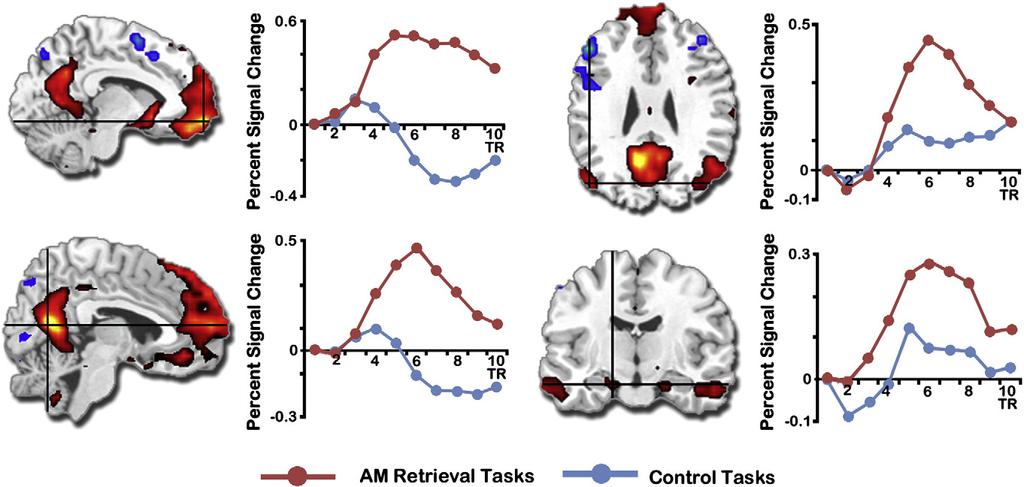 D.R. Addis et al. / NeuroImage 59 (2012) 2908 2922 2913 Fig. 3. Network associated with AM retrieval relative to control tasks.
