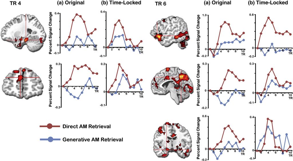 D.R. Addis et al. / NeuroImage 59 (2012) 2908 2922 Fig. 5. Network associated with direct relative to generative AM retrieval.
