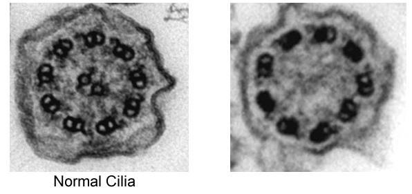 Written Response #22: What is different about this cilia?