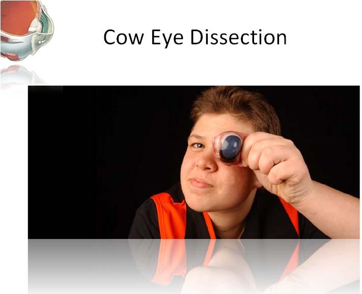 Nerves Cow Eye Dissection Optic Nerve (II) - Carries vision to the brain Oculomotor Nerve (III) - Innervates the superior rectus, levator,