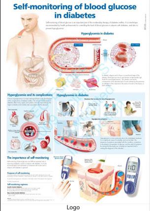 A2 Anatomical Posters Encapsulated Posters containing anatomical images and educational information on a specific disease