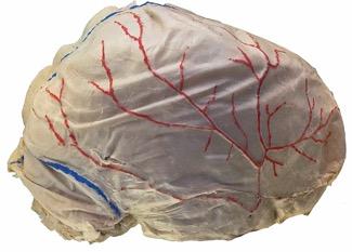 Meninges 3 layers of connective tissue surrounding brain and spinal cord: 1.