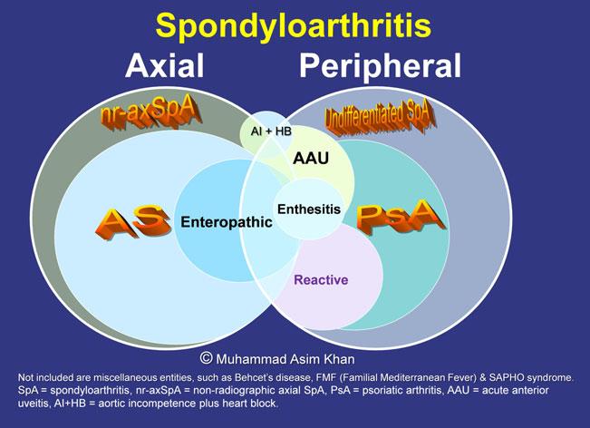 Fig. 1 Venn diagram showing spondyloarthritis and interrelated disorders. (Courtesy of Dr.