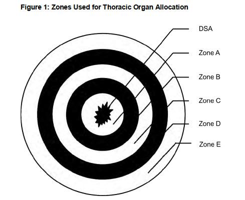 Each zone =
