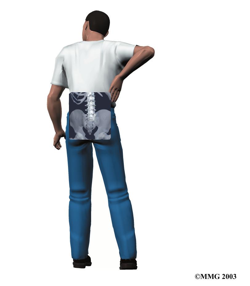 A Patient s Guide to Low Back