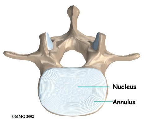 It provides most of the disc's ability to absorb shock. The nucleus is held in place by the annulus, a series of strong ligament rings surrounding it.