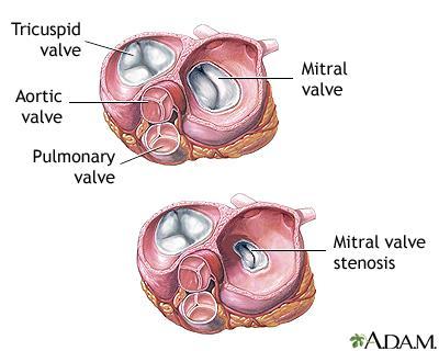 What is Non-valvular atrial
