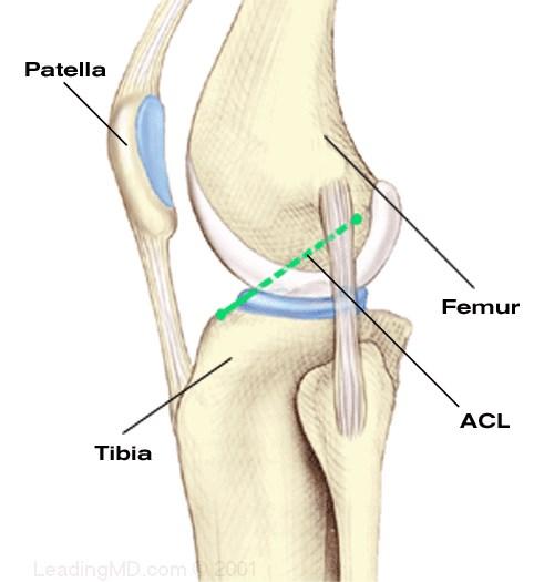 Introduction The anterior cruciate ligament (ACL) resists rotation and forward / backwards displacement of the tibia / femur.