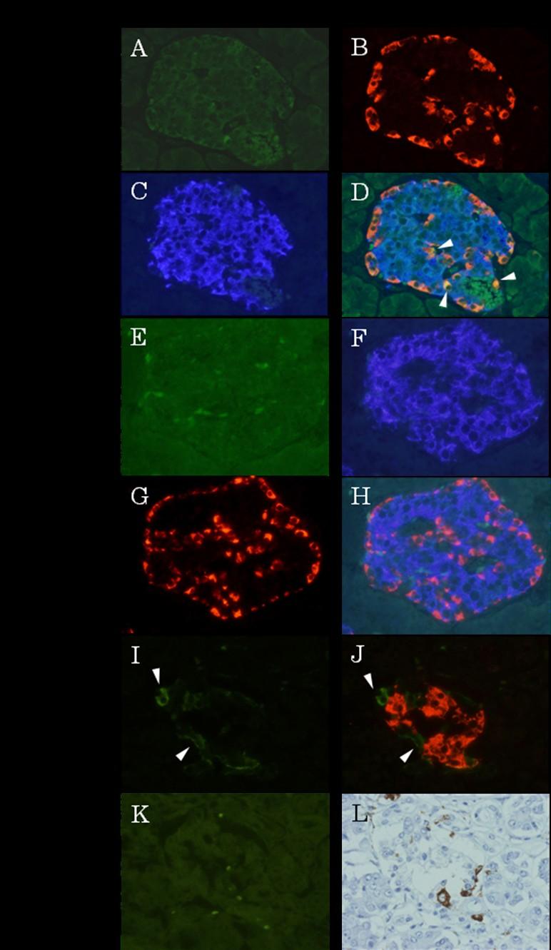 Supplementary Figure 1. Immunohistochemical staining in pancreas from non-diabetic controls (A-H) and patients with type 1 diabetes (I-L).