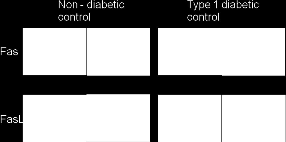 Fas was not stained in both non-diabetic controls and type 1 diabetic controls (A), (E).
