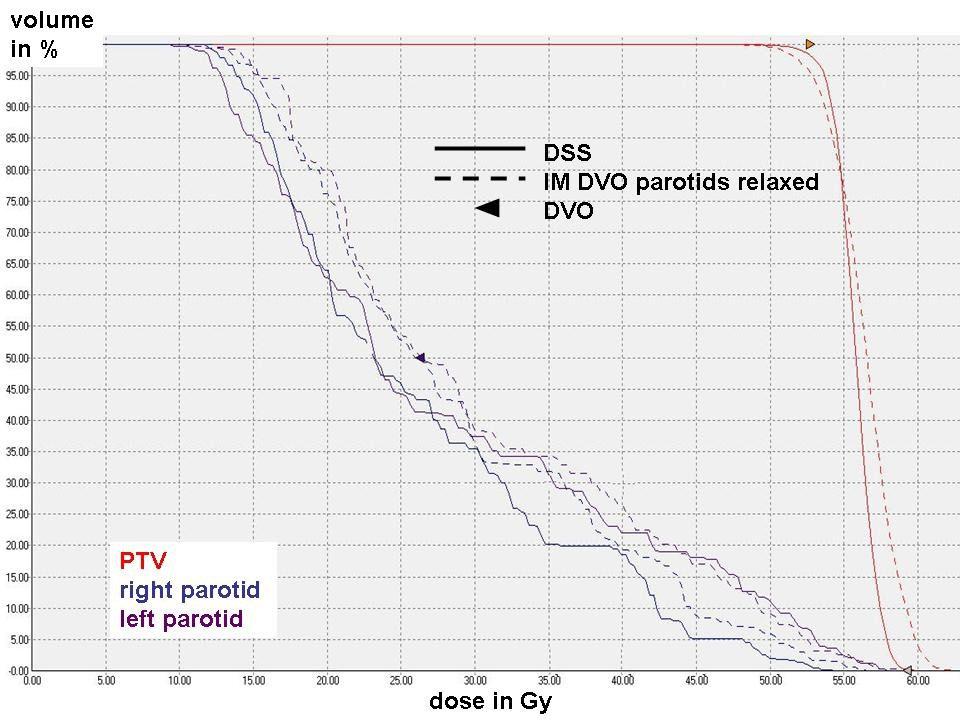 13 Dobler et al.: Direct machine parameter optimization for IMRT of oropharyngeal cancer 13 Fig. 5.