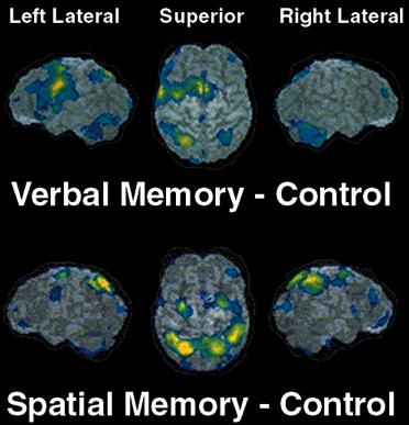 patients selectively impaired on object but not spatial WM, or vice versa Neuroimaging: In item recognition task, different neural