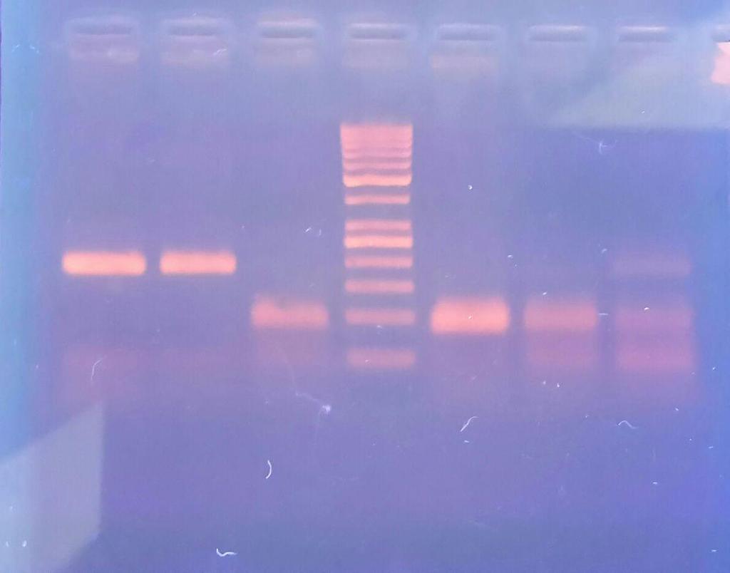 Interleukin-1β and Interleukin-6 Genetic