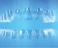 improved predictability Multi-tooth extrusion for anterior