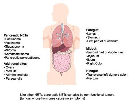 NEUROENDOCRINE TUMOURS (NETS) NETS By Anatomical Site: Pituitary gland: Neuroendocrine tumor of the anterior pituitary Thyroid gland: - medullary carcinoma Parathyroid tumors Thymus and mediastinal