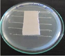 Testing process: In this work, the qualitative agar diffusion test and the quantitative