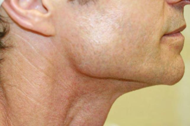 neck with roadand Light therapy at least once per year (). Figure 3.
