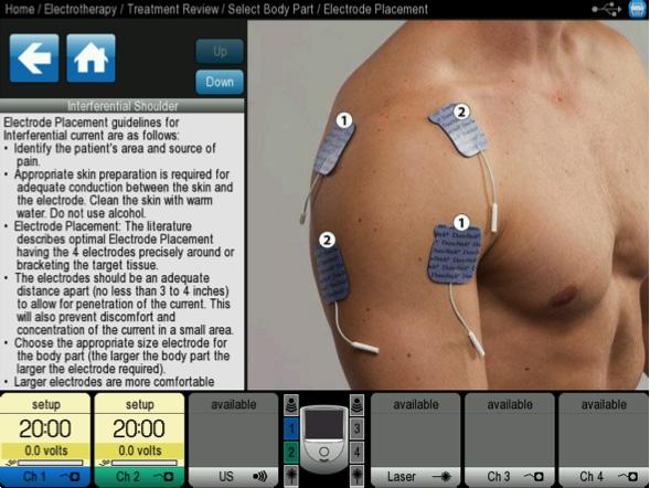 Electrotherapy Neo provides suggestions for electrode placement, care