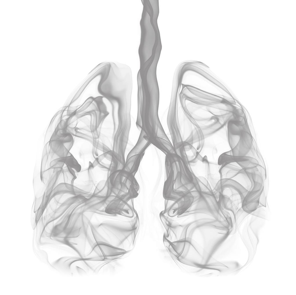 Chapter 5 Risk profile and clinical outcome of symptomatic subsegmental acute pulmonary embolism P.L. den Exter, J.