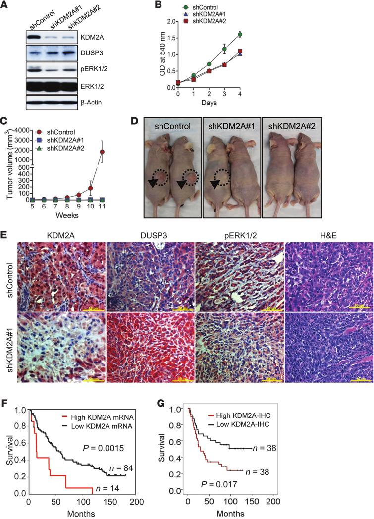 research article Figure 8 Stable knockdown of KDM2A drastically inhibits tumor growth of NSCLC cells in vivo, and high KDM2A correlates with poor prognosis of lung cancer patients.