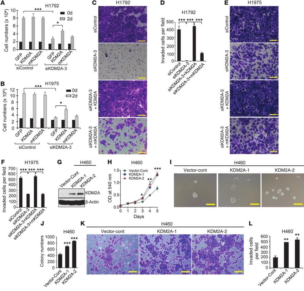research article Figure 3 KDM2A s catalytic activity is indispensable for in vitro proliferation and invasiveness of NSCLC cells, and stable KDM2A overexpression promotes cell proliferation,