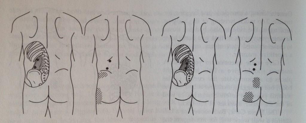 C. Quadratus lumborum Manually with hands Manually with tennis ball (roll against the wall, or while lying down with the