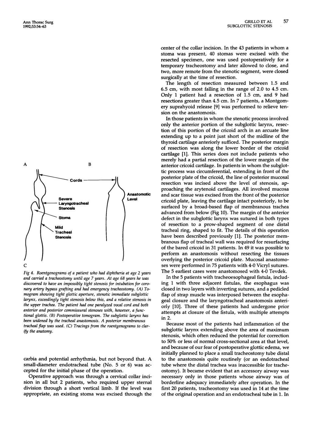 nn Thorac Surg 1992;535&63 GRILL0 ET L 57 -tracheal stenosis Mild Tracheal stenosis I I nastotnotic Level C Fig 4.