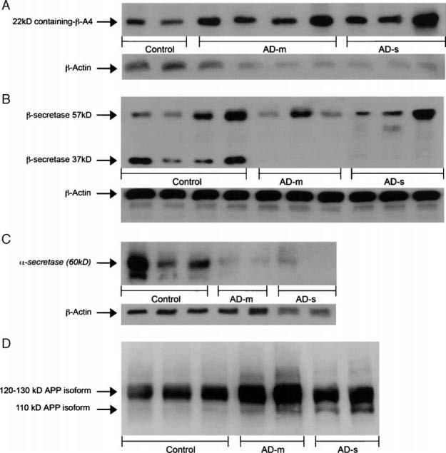 Platelet Amyloid Precursor Protein Processing: A Bio-marker For Alzheimer's Disease K. Tang et al.