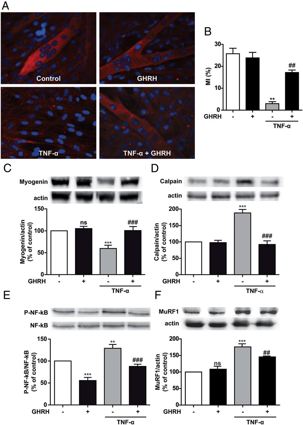 doi: 10.1210/EN.2015-1098 press.endocrine.org/journal/endo 3249 Figure 6. GHRH protective effects against TNF- -induced protein degradation and activation of proteolytic pathways.