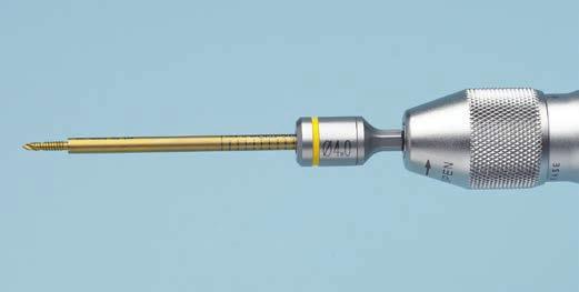 Secure the adapter into the chuck of a power drill, then load the Schanz screw into the adapter. Using the cannula as a guide, drive the Schanz screw into the mandible down to the stop.