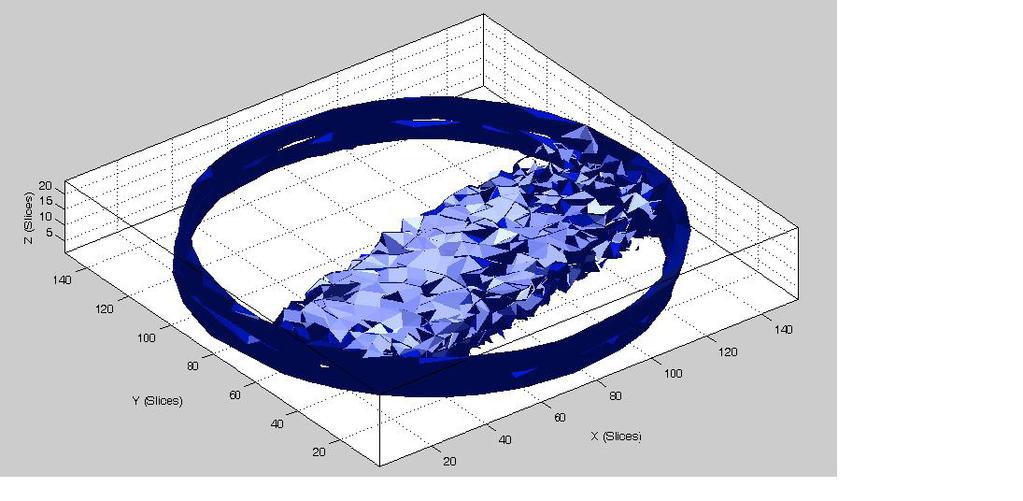 Figure 2 shows an isosurface plot drawn in MATLAB where the irradiated volume is clearly identifiable, demonstrating the ability of zero scan method for the volumetric reconstruction of gel images.