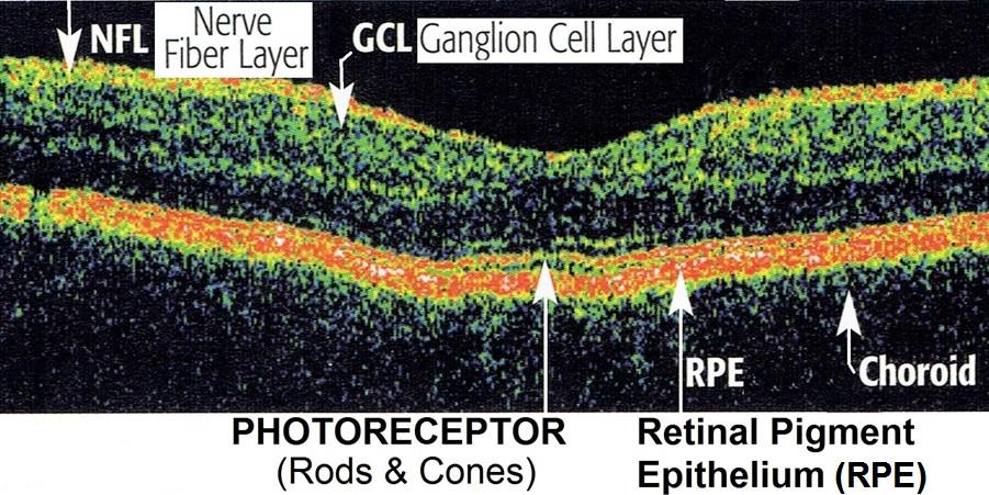 ) The photoreceptor layer contains RODS & CONES Rods & Cones convert light to an electro-chemical impulse, which gets passed
