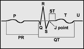 Sequence of Excitation Impulse passes from SA node AV node ventricles via the atrioventricular bundle (Bundle of His) Bundle of His splits into two pathways in the interventricular septum (Bundle