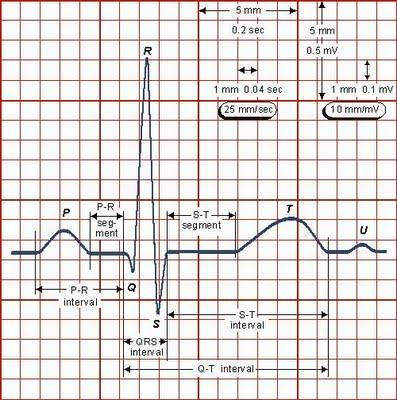 Interventions If you see a lethal arrhythmia(v-fib, asystole, v-tach without a pulse, etc.