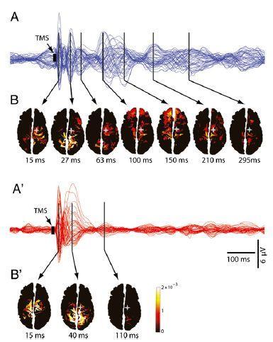 3. The future Functional correlates Feedback and feed-forward fronto-parietal connectivity