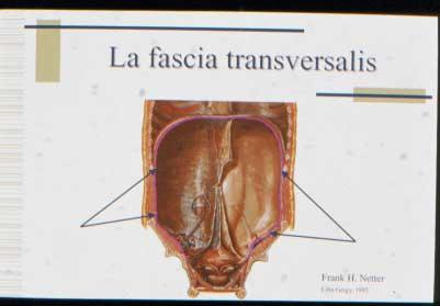 transversus muscle, about one-fourth to one-fifth down the Recti,