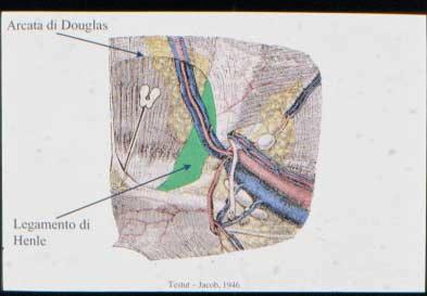 Fig. 7 Moving downwards to the region in question we can start from the semicircular line of Douglas: at this point the TF thickens medially to form Henle s ligament (Fig.