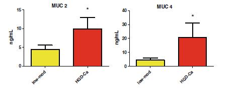 Pancreatic Cystic Fluid Concentration (ng/ml, ELISA) Serum level of MUC5AC (ng/ml, ELISA)