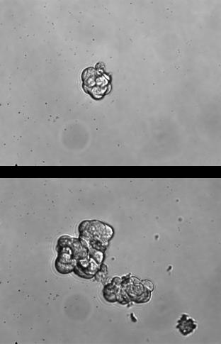 stem cell-like phenotype * *
