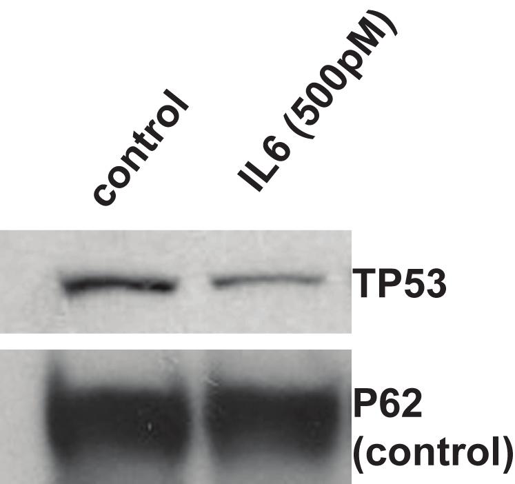 Results: IL6 treatment downregulated TP53 wild-type protein