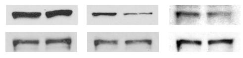 Results: IL6 treatment also downregulated TP53 protein in