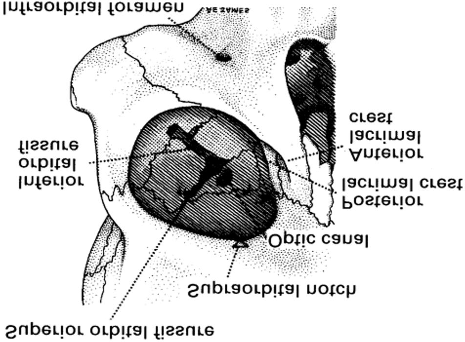 Figure 2 Diagrammatic representation of the angles of the lateral and medial walls of the orbits in transverse section. The needles are 2.5 cm from shoulder to point.