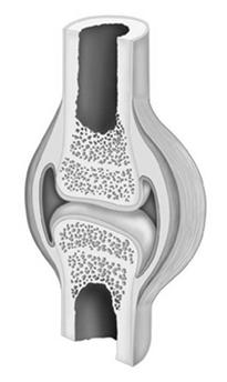 SYNOVIAL JOINTS Joint Capsule Surrounds the joint and provides support Lined with synovial membrane that secretes