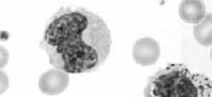 Summary of human NK cell subsets Peripheral blood lymphocytes CD56-P PE CD16-FITC CD56 bright