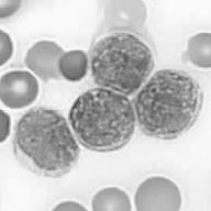 CD3-FITC 25 IL-15tg mice: acute T-NK lymphoblastic leukemia CD3+ T Cells Cell number 53% TCR Vβ6 26 FLT3 AML/ALL ITD FL IL-15 NK