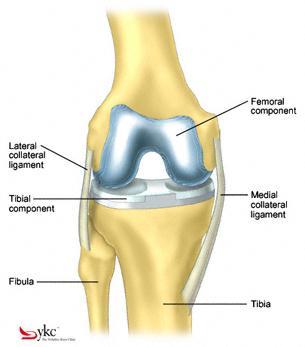 Rehabilitation after your Knee Replacement Surgical Rehabilitation Team