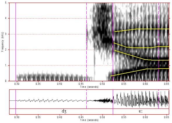 Figure 22: Spectrogram of /dz/. Click anywhere on the image to hear the sound. Several features are evident in this spectrogram. This is a pre-voiced sound (negative VOT) with about 0.