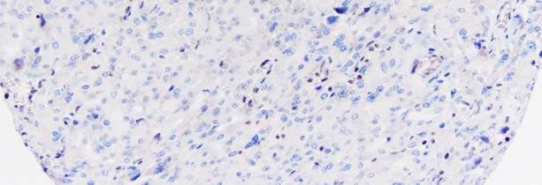 cells and lymphocytes BAP1