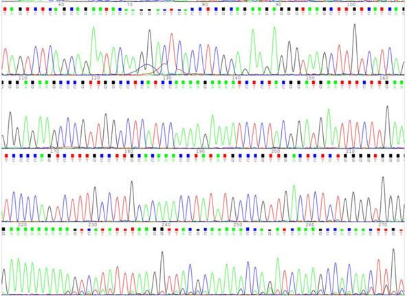 SPOP mutation and breast cancer 12365 Figure 2. The partial DNA sequencing profiles of a representative individual. The DNA was cut and purified from agarose gel for Sanger sequencing.