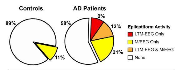 Subclinical Epileptiform Activity in Patients With Alzheimer Disease & Controls LTM =
